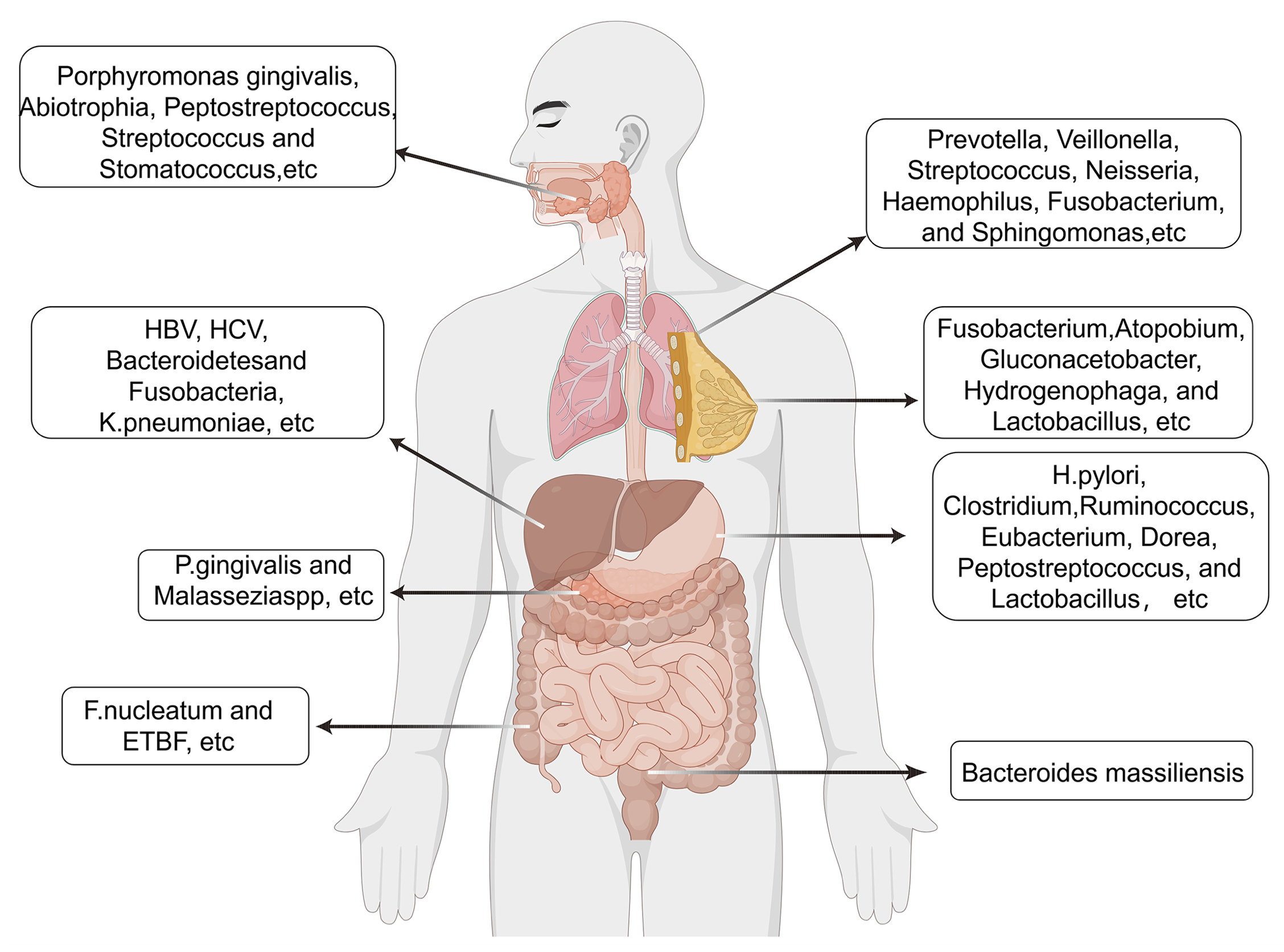 Diagram of microbiome signatures across cancer types and their clinical implications