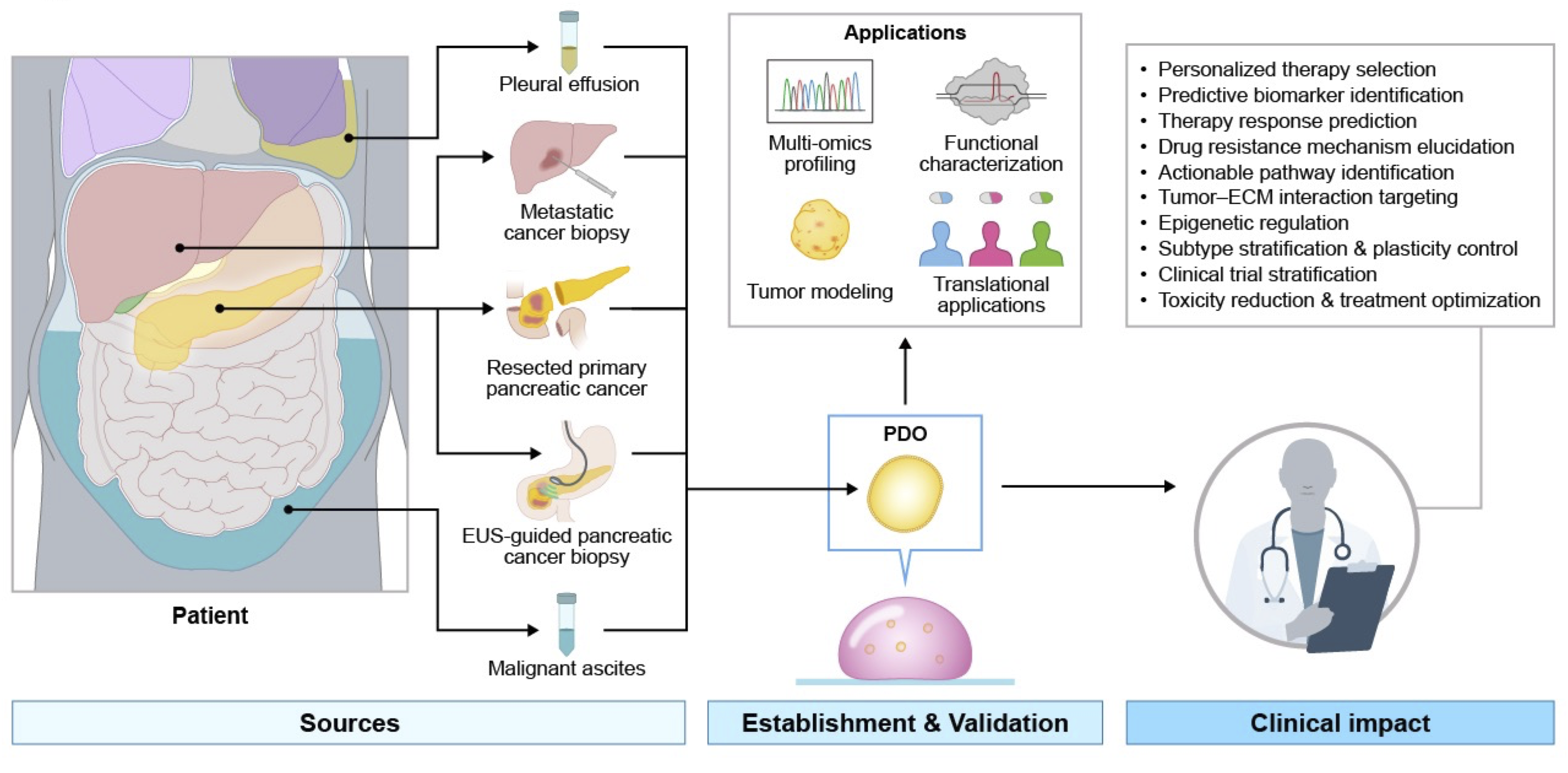 Figure illustrating the generation of pancreatic cancer patient-derived organoids from clinical specimens and their applications in functional testing, multi-omics profiling, biomarker discovery, and precision treatment selection.