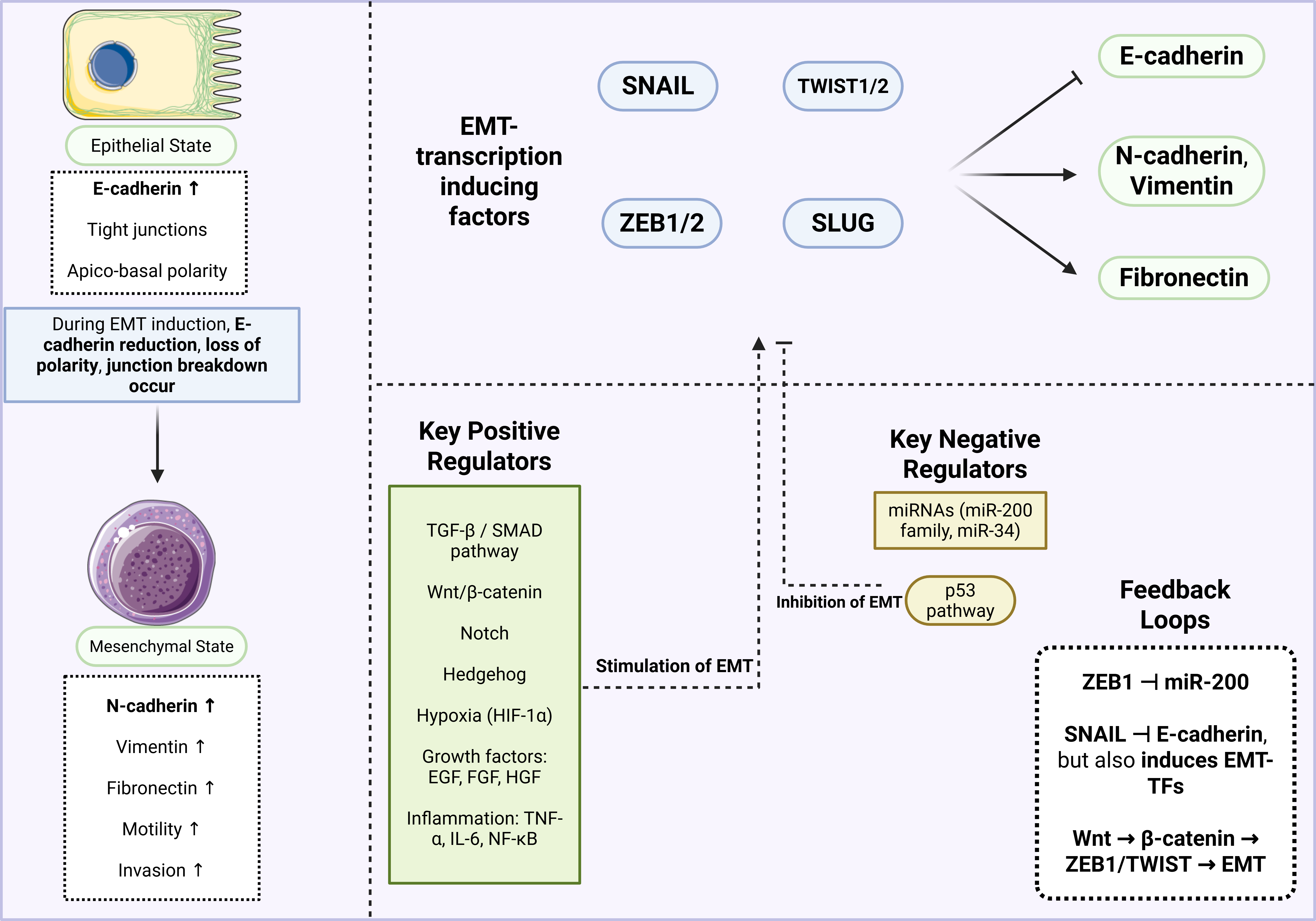 Diagram of signaling pathways regulating epithelial–mesenchymal transition in cancer