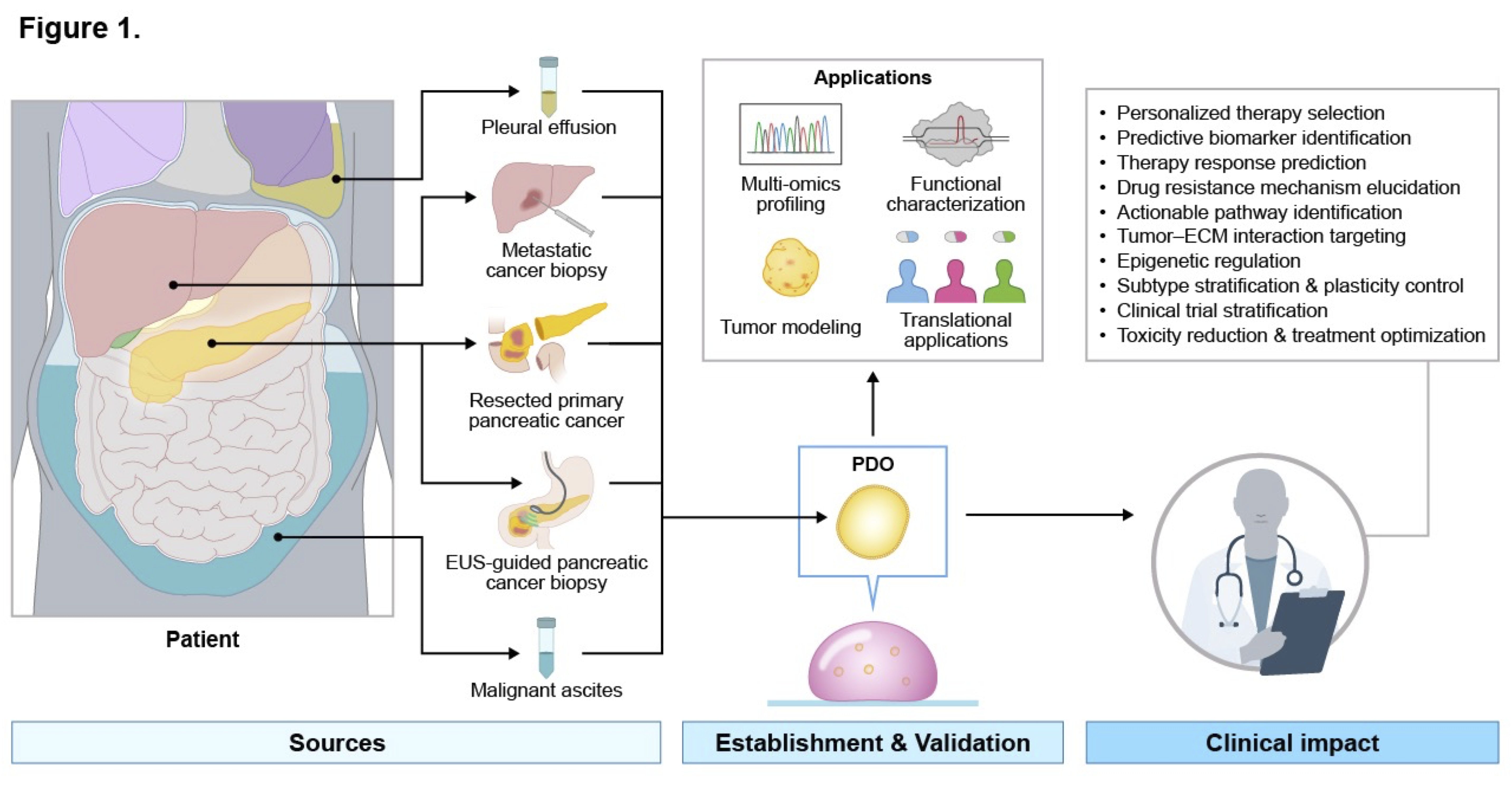 Diagram illustrating the workflow for generating pancreatic cancer patient-derived organoids (PDOs) from multiple specimen sources, including pleural effusion, metastatic biopsy, resected primary tumors, EUS-guided biopsies, and malignant ascites.