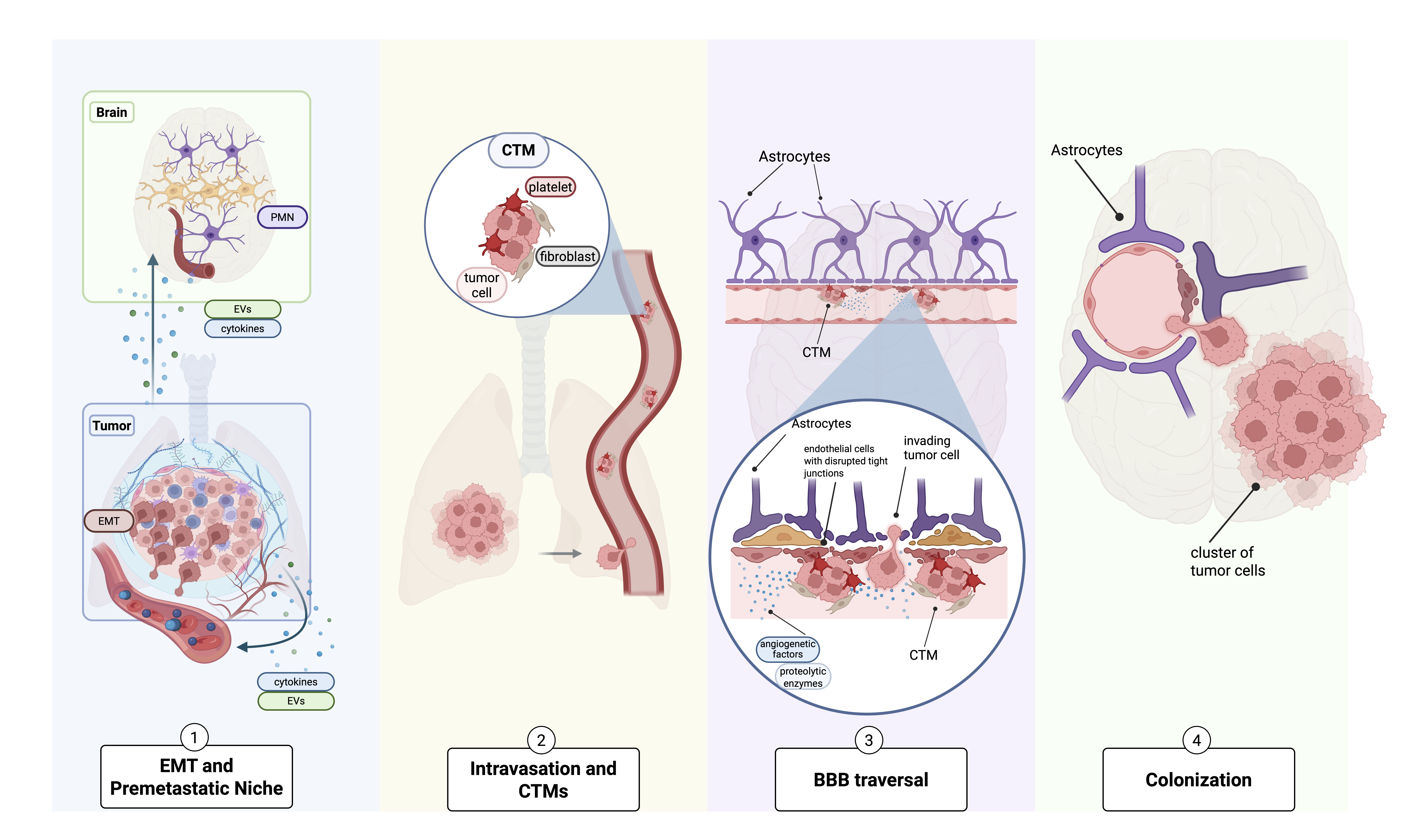 Breast cancer brain metastasis progression from tumor cell dissemination to blood–brain barrier traversal and brain colonization.